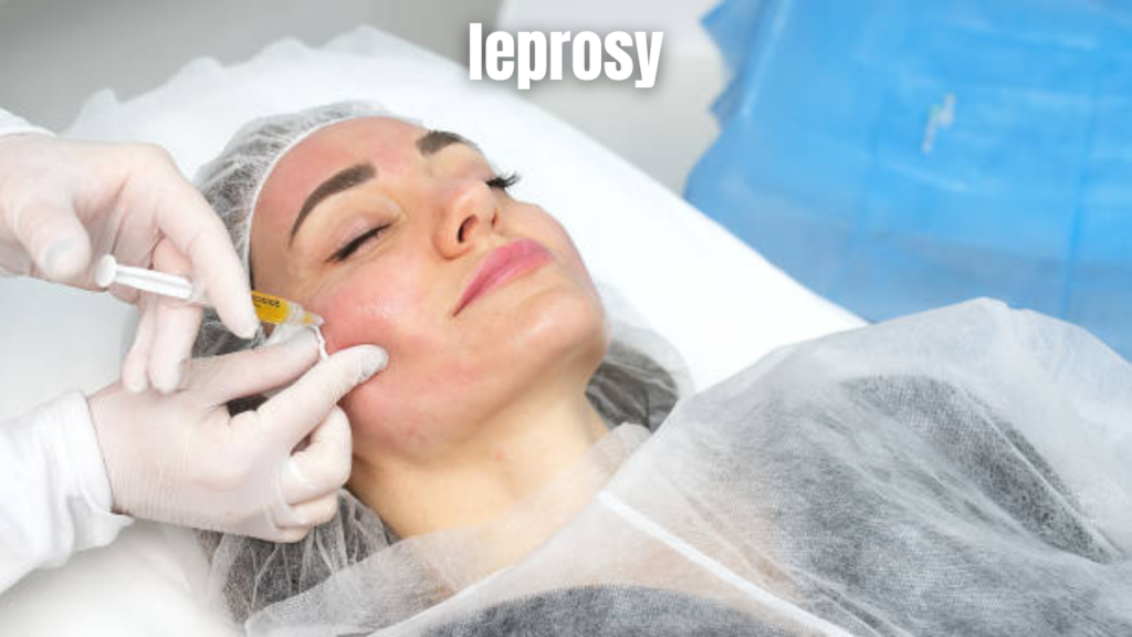 leprosy